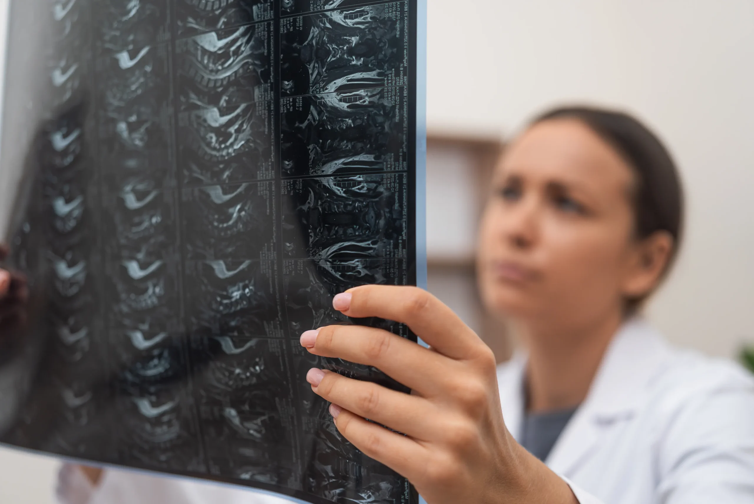 Doctor reviewing an MRI for back pain scan with a patient